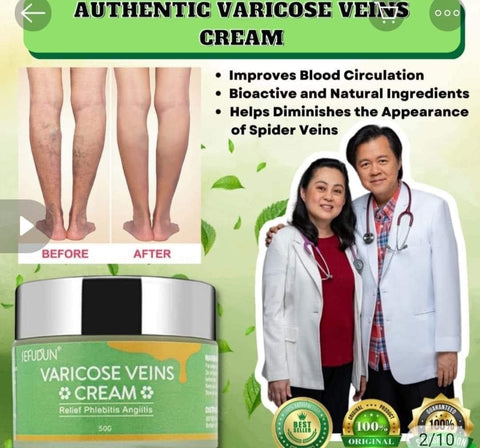 Varicose Vein Cream