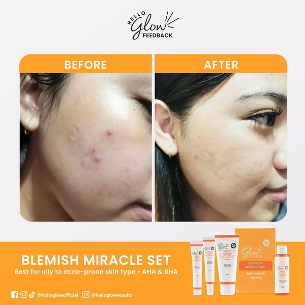 Hello Glow Blemish Miracle Set