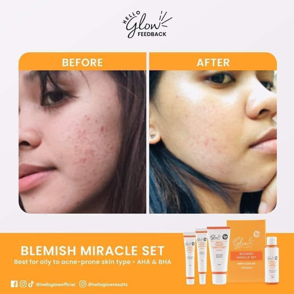 Hello Glow Blemish Miracle Set