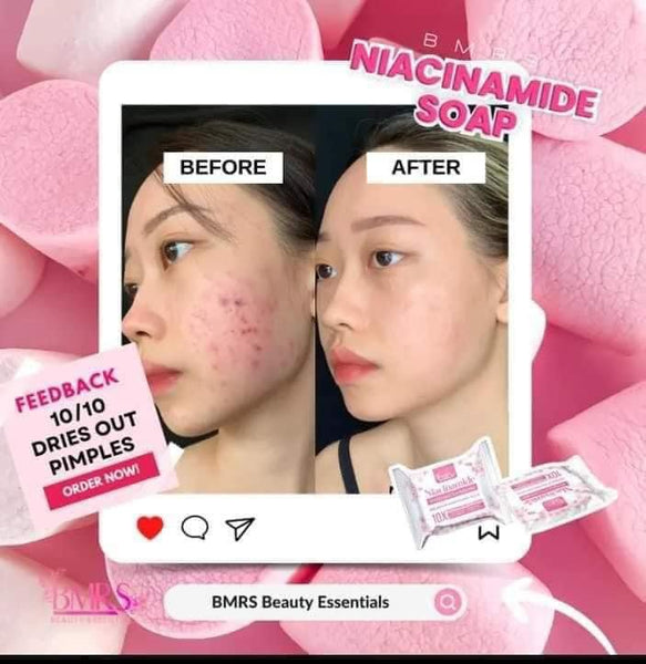 BRMS Original Niacinamide with Glutathione Soap