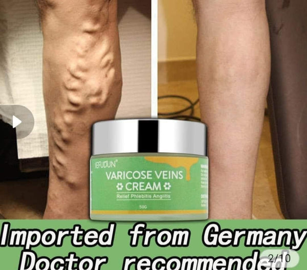 Varicose Vein Cream