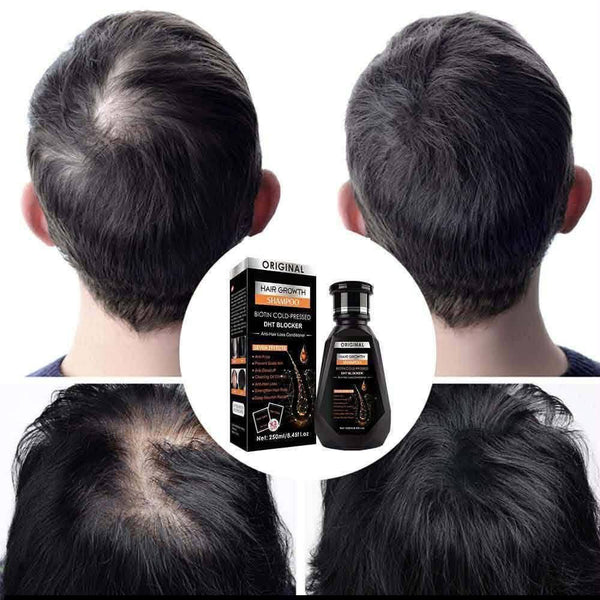 Hair Growth Shampoo