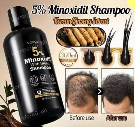 KORMESIC 5% Minoxidil With Biotin Shampoo 300ml