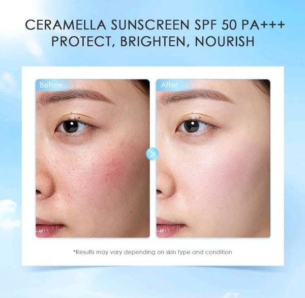 The Originote Ceramella Sunscreen