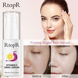 VITAMIN-C SNAIL SERUM BY RtopR