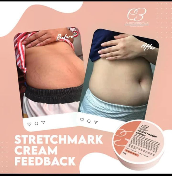 Clarity Essential Stretchmark Cream