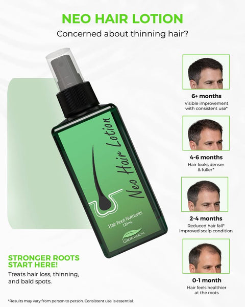 Neo Hair Lotion - Hair Loss Treatment by GreenWealth 120ml
